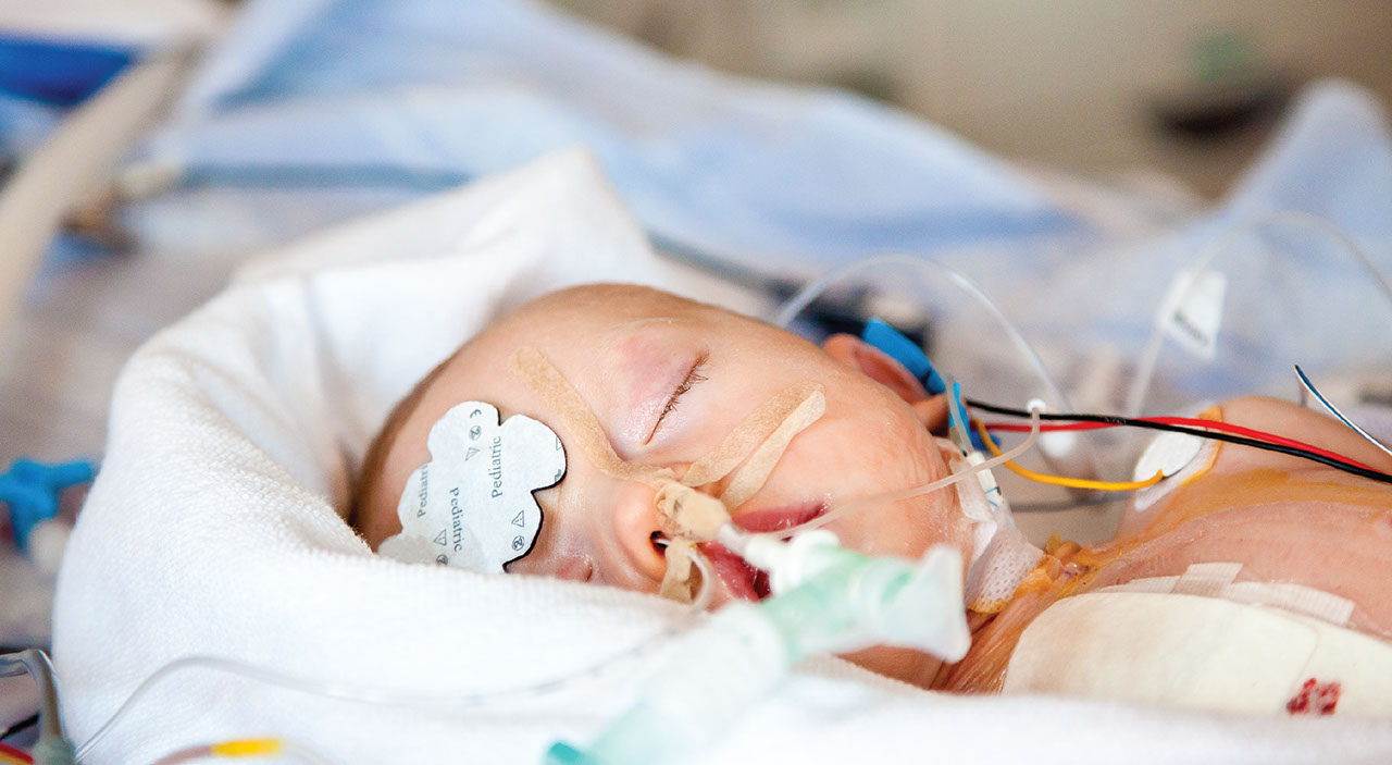 Preterm baby in the Nicu with tubes in nose and monitors on head and body